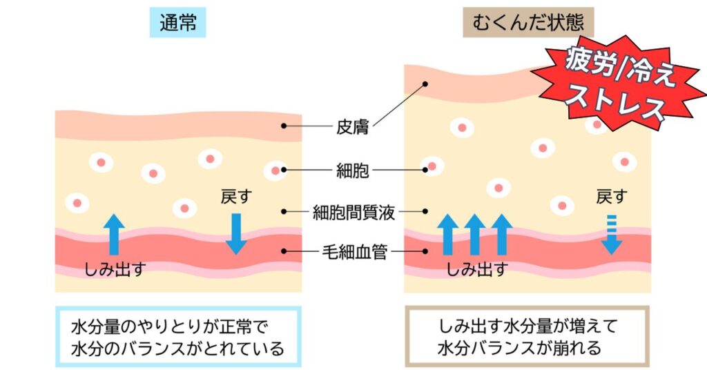 むくみのメカニズム