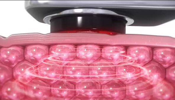 エレキリフトのRF