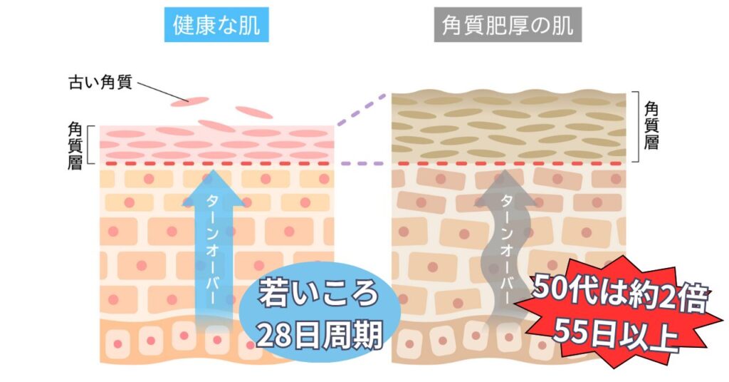 ターンオーバーの変化