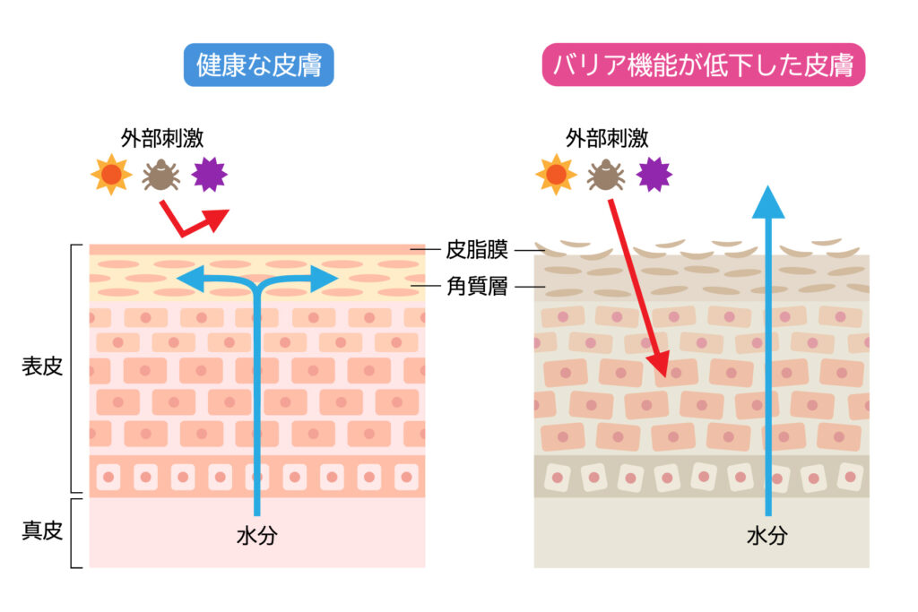 肌のバリア機能低下