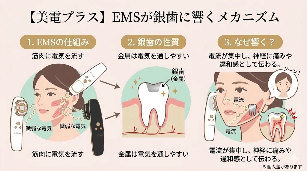 EMSが歯に響く理由